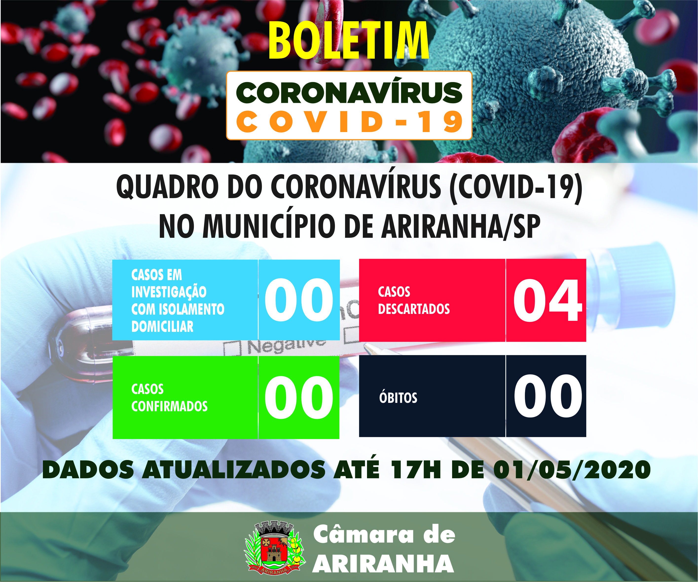 Boletim diário Corona Vírus (COVID-19) – 01/05/2020